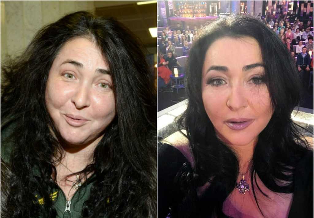 Когда пластика пошла во вред: 20 звезд, которые испортили себе лицо | simpleslim